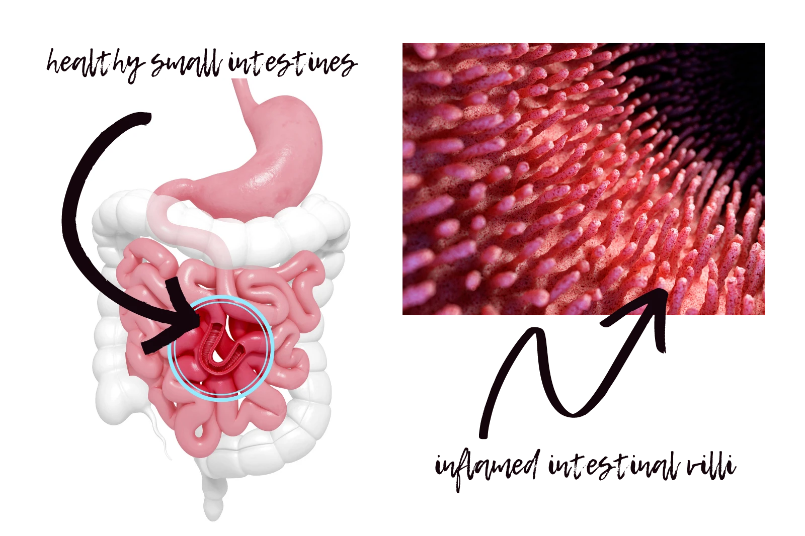 diagram of intestines